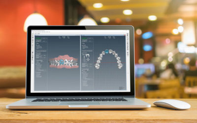 OrthoSelect anuncia el lanzamiento del software DIBS AI para mejorar tratamientos de ortodoncia